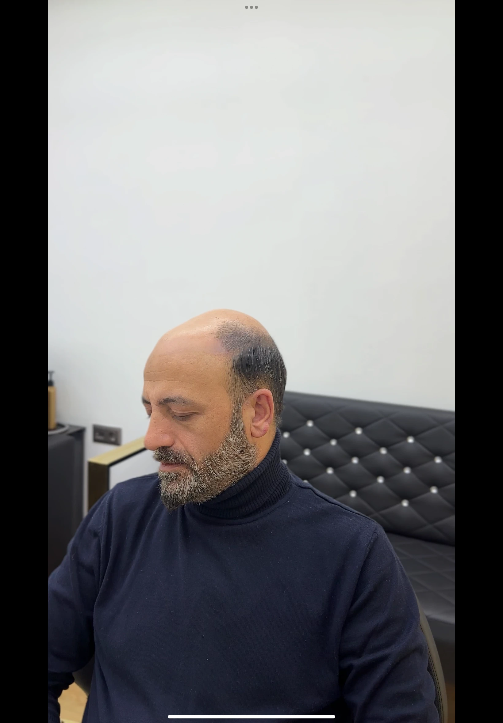 Değişim 20: Öncesi