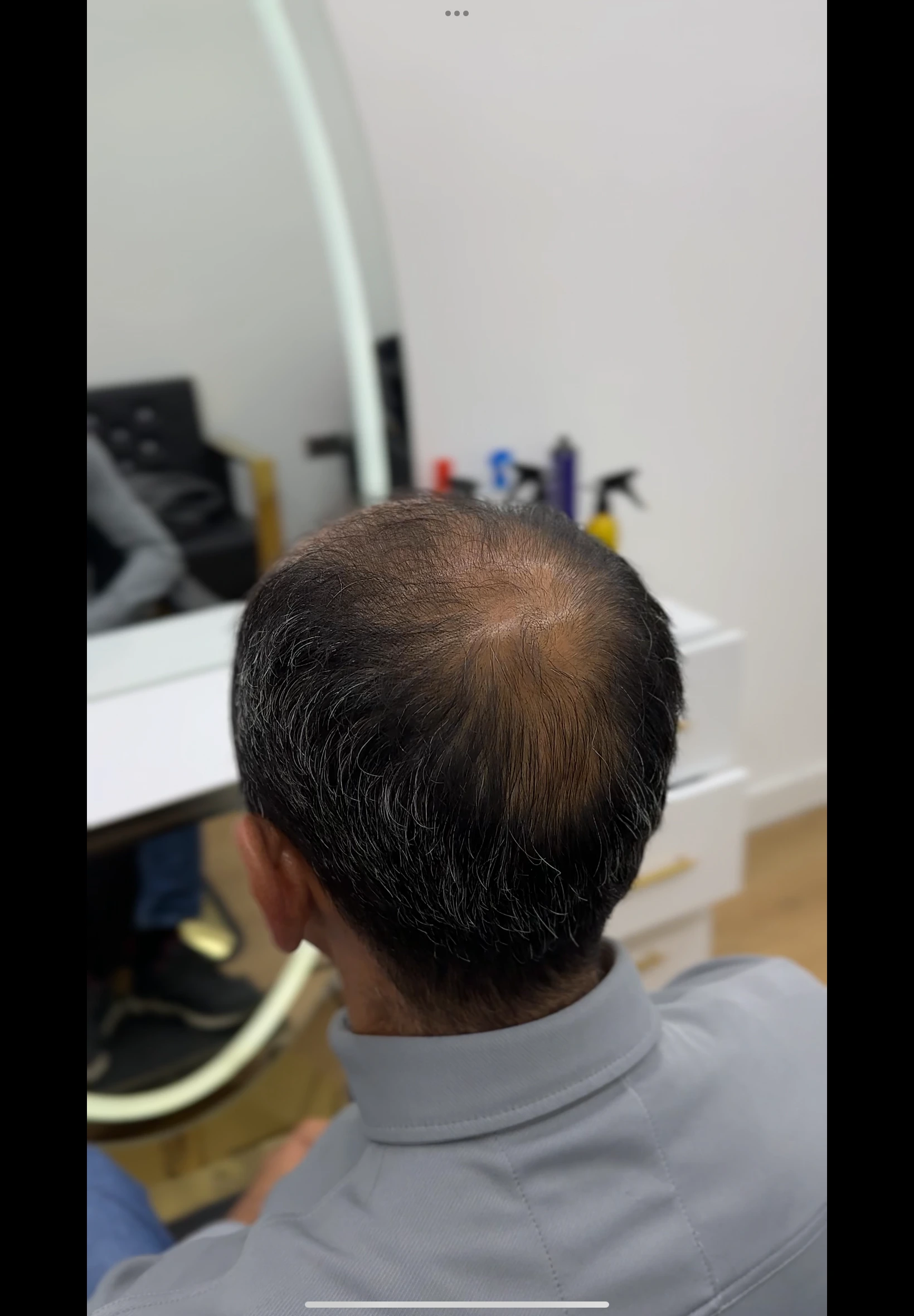 Değişim 44: Öncesi