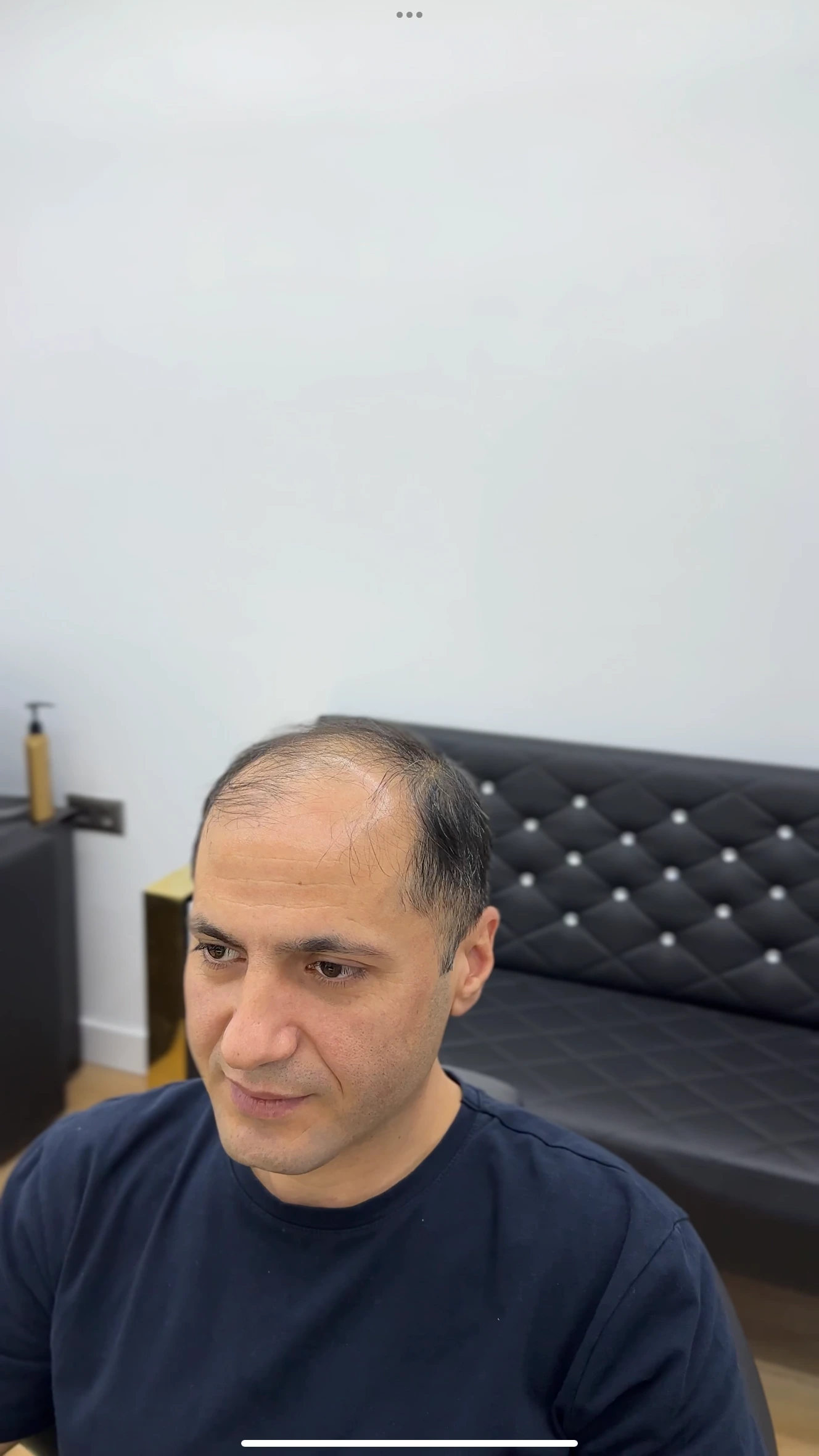 Değişim 49: Öncesi