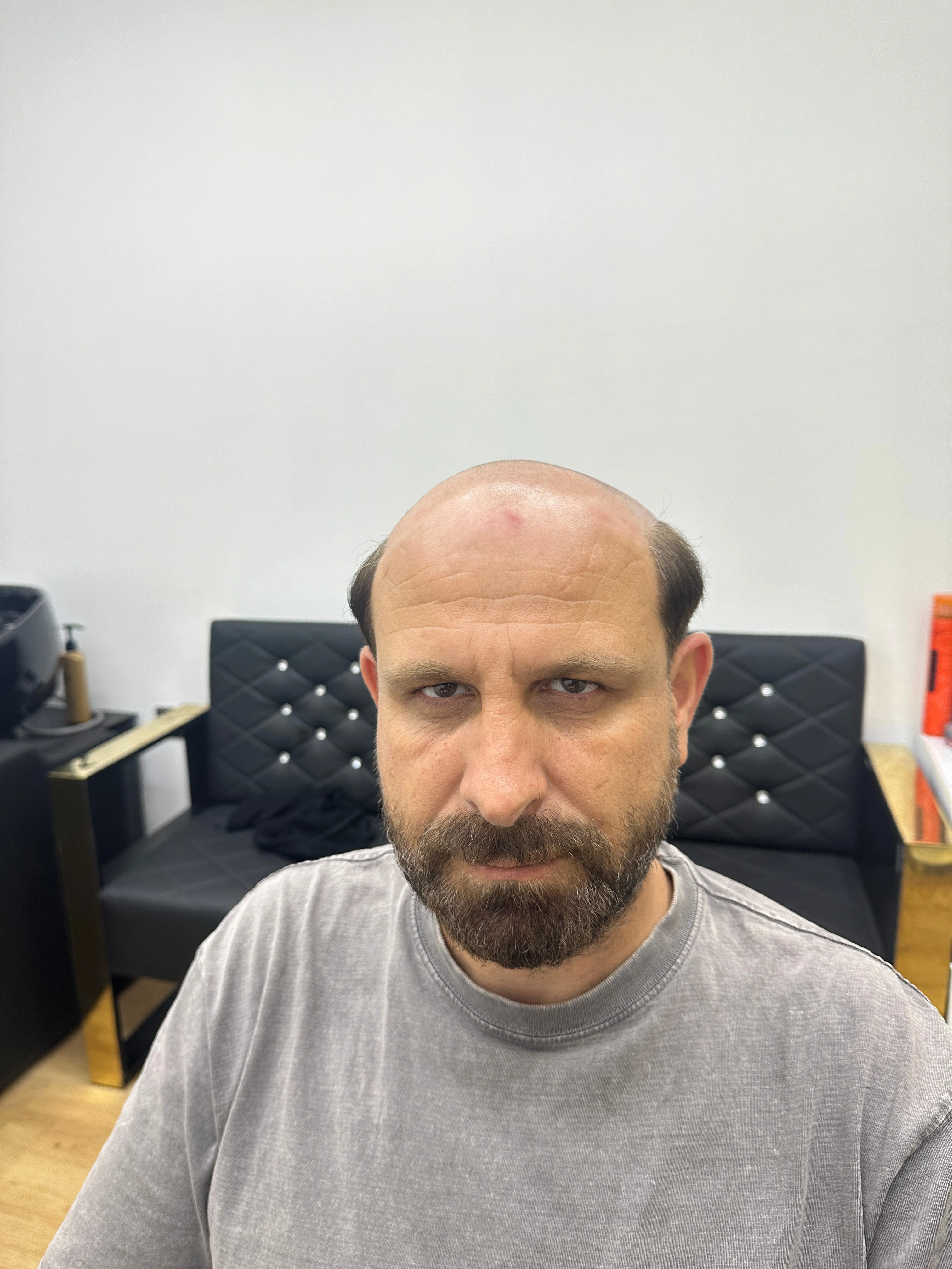 Değişim 53: Öncesi
