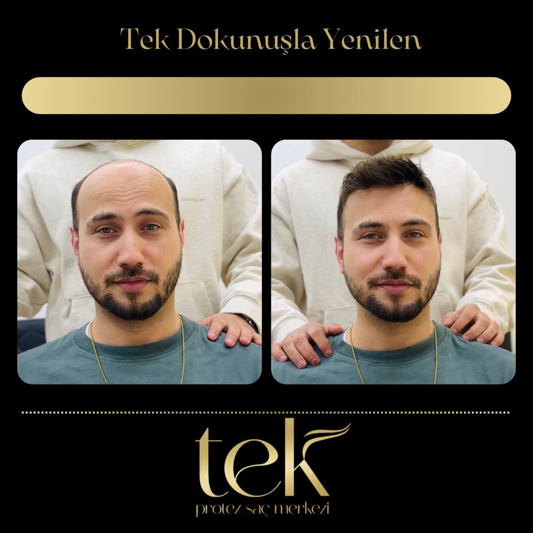 Uygulama 1: solda önceki, sağda sonraki görünüm